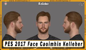 فیس Caoimhin Kelleher