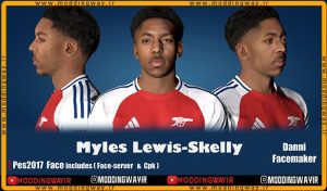 فیس Myles Lewis-Skelly